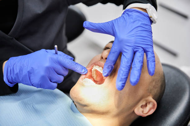 Best Dentist for Tooth Abscess  in Montague, CA
